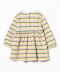 Striped